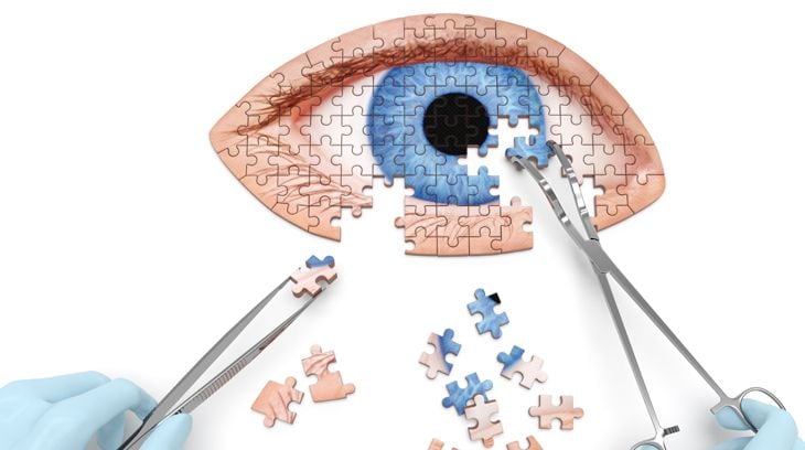 eye puzzle
